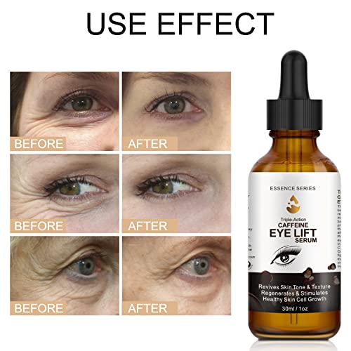 Caffeine Eye Serum - with EGCG, Vitamin C, Hyaluronic Acid, Collagen, Caffeine Eye Lift Serum - Reduces Puffiness, Dark Circles, Under Eye Bags, Wrinkles and Fine Lines Around The Eyes (30ml)