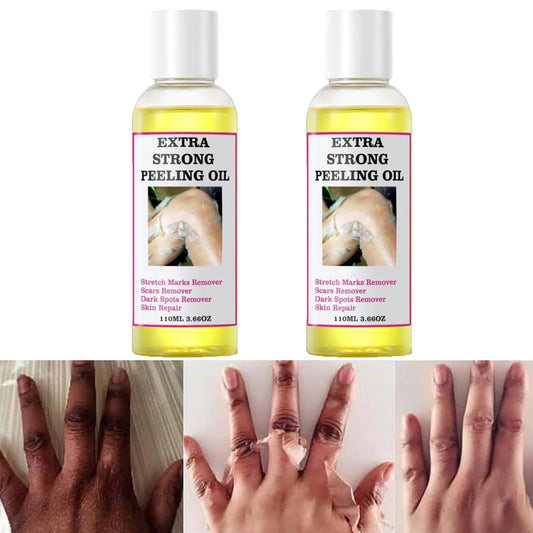 Chemical Peel Oil for Face & Body, Extra Strong Yellow Peeling Oil for Dark Skin Remover, Chemical Exfoliant Peel Solution with Gentle Formula for All Skin Type - 3.88 FL.Oz/110 ML (2 PCS)