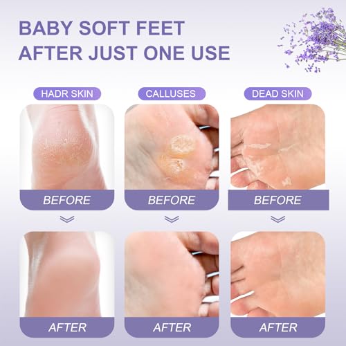 FUNNIR Foot Peeling Mask (5 Pack) Exfoliant for Peeling Off Calluses, Natural Exfoliator for Dry Dead Skin, Callus, Repair Rough Heels Soft Smooth Touch