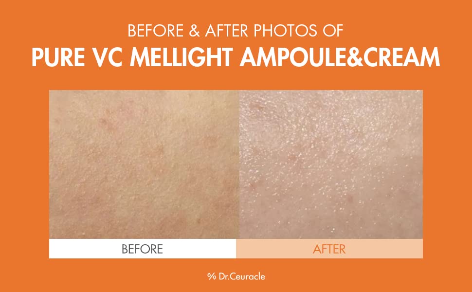 Dr.Ceuracle Pure VC Mellight Ampoule - Vitamin C Serum for Face, One Week Program for Anti-Oxidant, Firming, Clarify, Fade Pigmentation, Skin Radiance (4 Counts (Pack of 1))