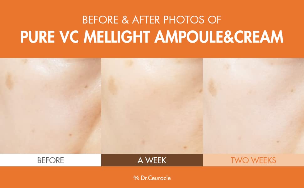 Dr.Ceuracle Pure VC Mellight Ampoule - Vitamin C Serum for Face, One Week Program for Anti-Oxidant, Firming, Clarify, Fade Pigmentation, Skin Radiance (4 Counts (Pack of 1))