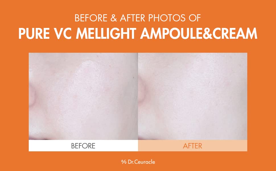 Dr.Ceuracle Pure VC Mellight Ampoule - Vitamin C Serum for Face, One Week Program for Anti-Oxidant, Firming, Clarify, Fade Pigmentation, Skin Radiance (4 Counts (Pack of 1))