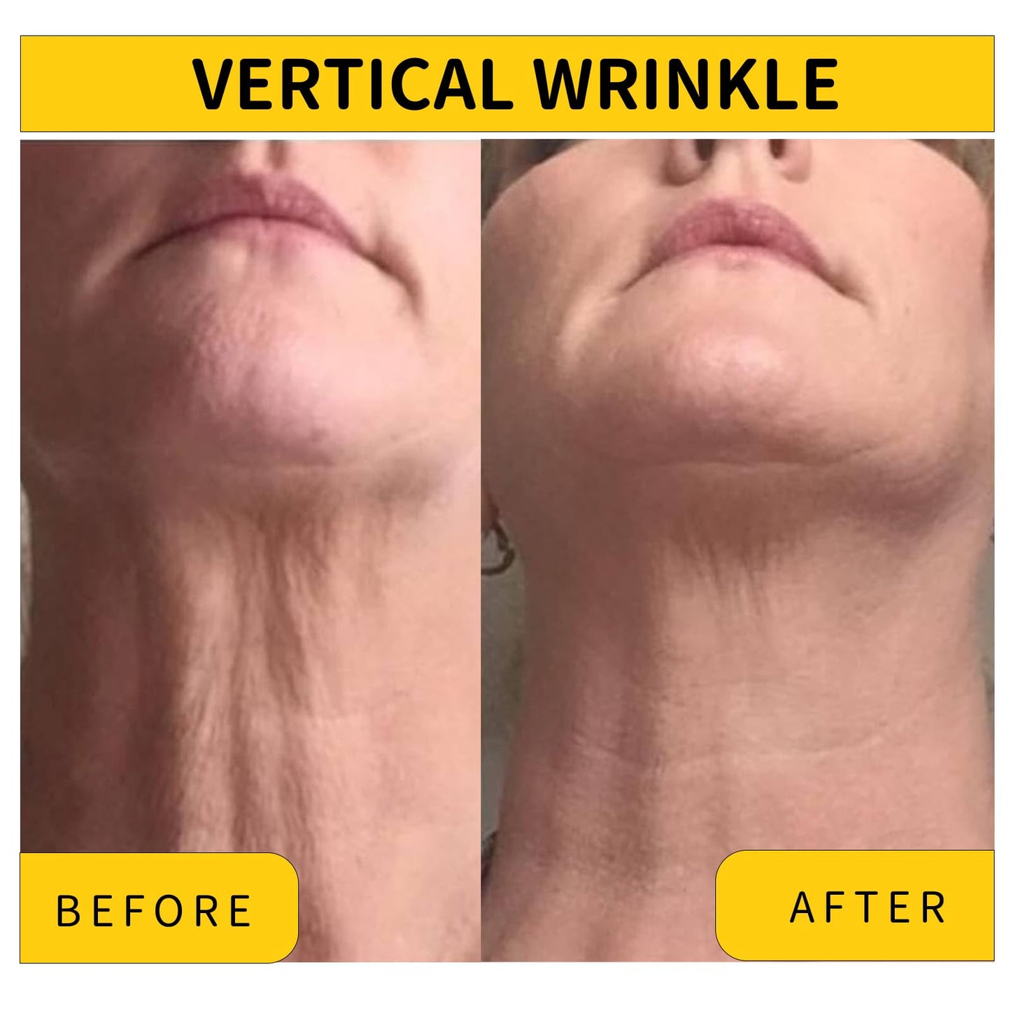 Irismistx Neck Cream, Neck Tightening Cream, Skin Firming & Anti Wrinkle Face Cream, Skin Tightening Cream for Face, Neck, Chest & Décolleté.