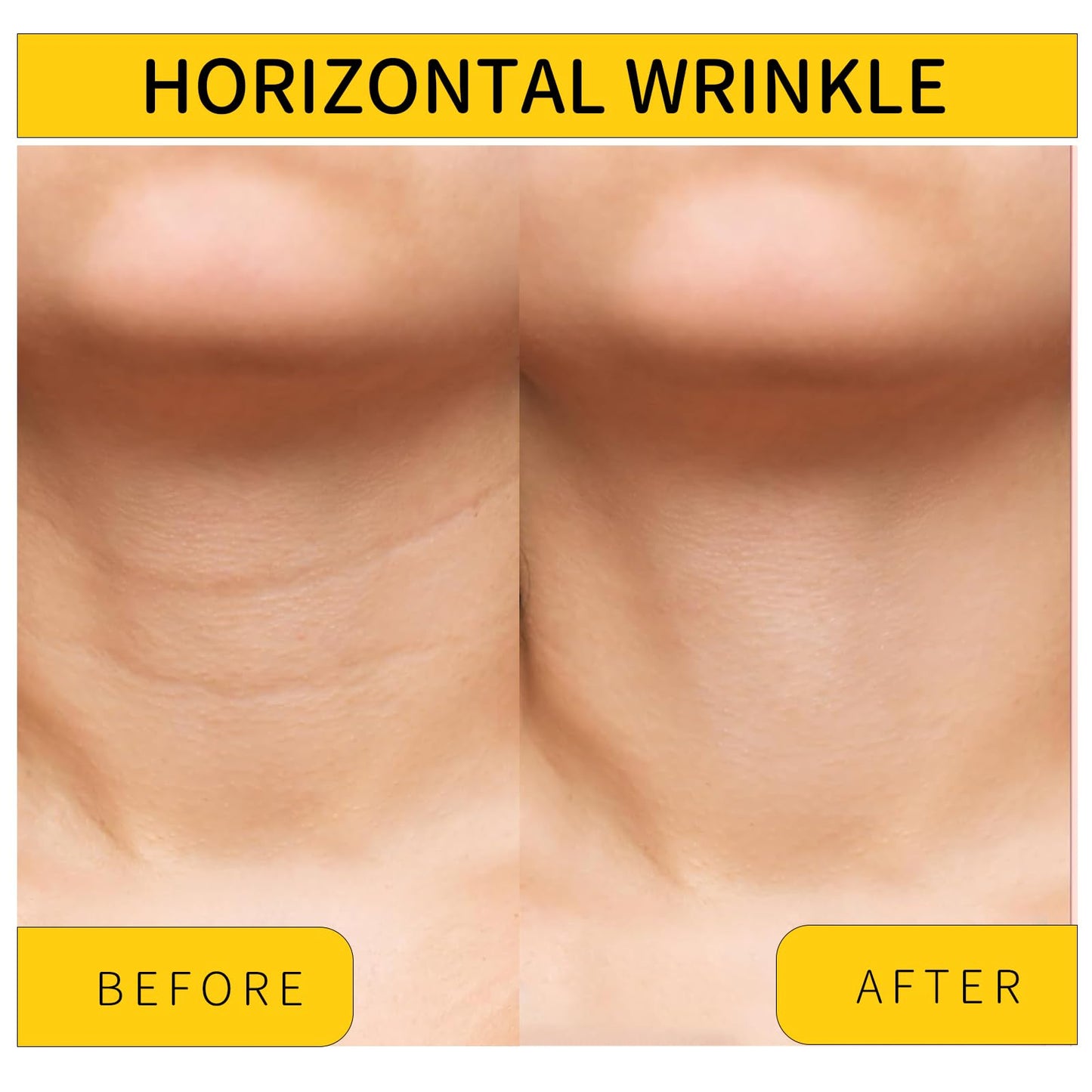 Irismistx Neck Cream, Neck Tightening Cream, Skin Firming & Anti Wrinkle Face Cream, Skin Tightening Cream for Face, Neck, Chest & Décolleté.