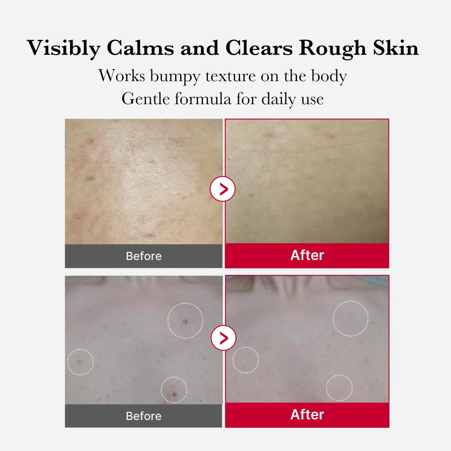 medicube Red Body Peeling Shot, AHA + BHA Exfoliating Body Spray for Summer-Ready Smooth Skin, Treats Strawberry Skin, Bumps & Breakouts, 3.88 oz