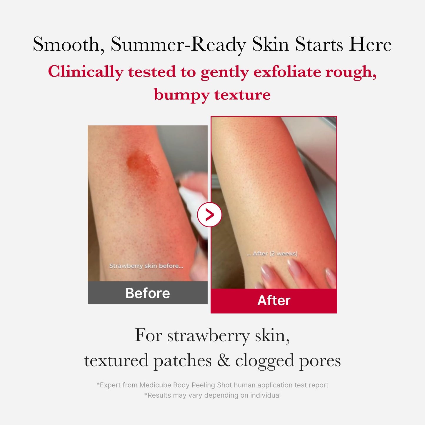 medicube Red Body Peeling Shot, AHA + BHA Exfoliating Body Spray for Summer-Ready Smooth Skin, Treats Strawberry Skin, Bumps & Breakouts, 3.88 oz