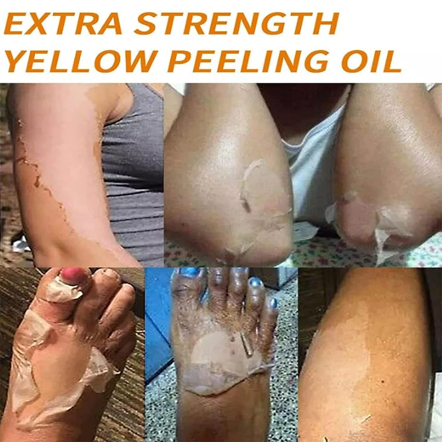 Extra Strong Peeling Oil, Yellow Peeling Oil for Dark Skin, Exfoliating Peeling Solution for Body, Hand, Feet and Face All Skin Type (110ML/3.88 Fl Oz) (1pcs)