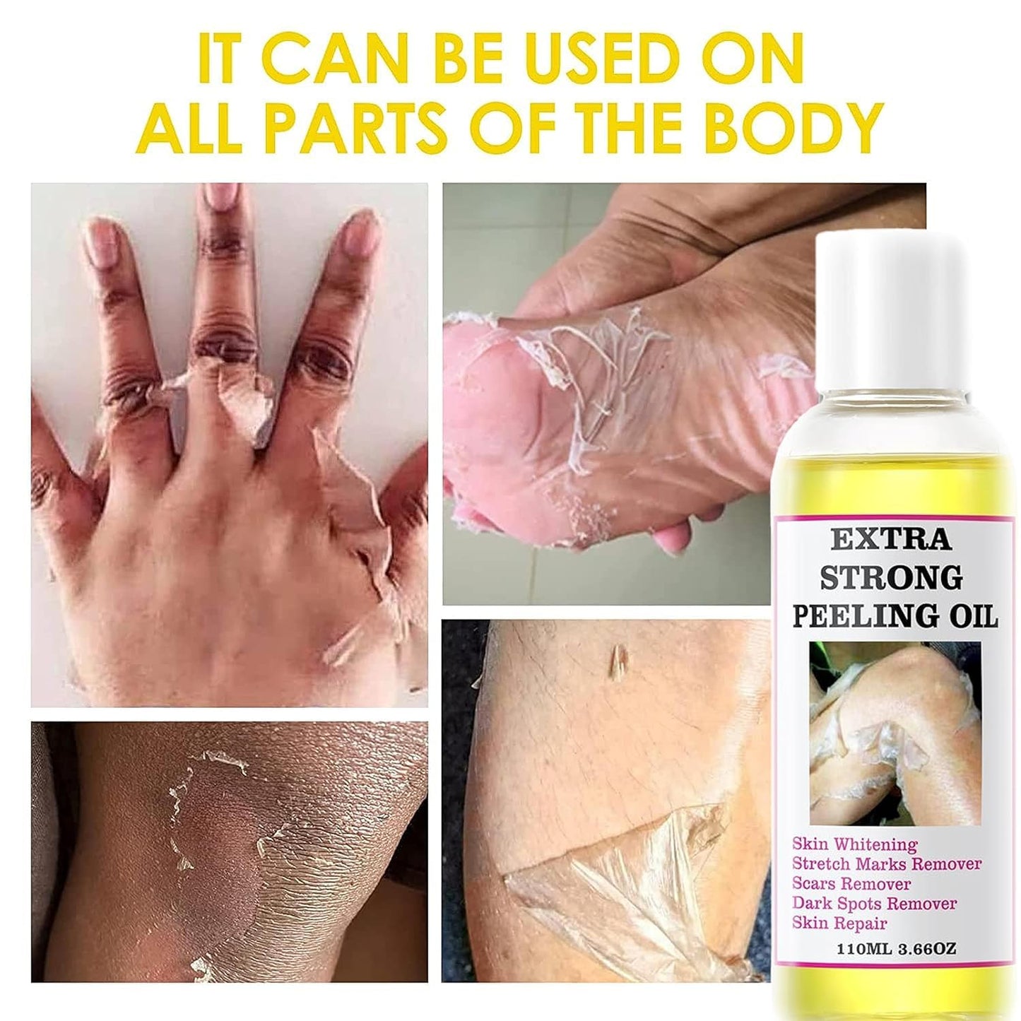 Extra Strong Peeling Oil, Yellow Peeling Oil for Dark Skin, Exfoliating Peeling Solution for Body, Hand, Feet and Face All Skin Type (110ML/3.88 Fl Oz) (1pcs)