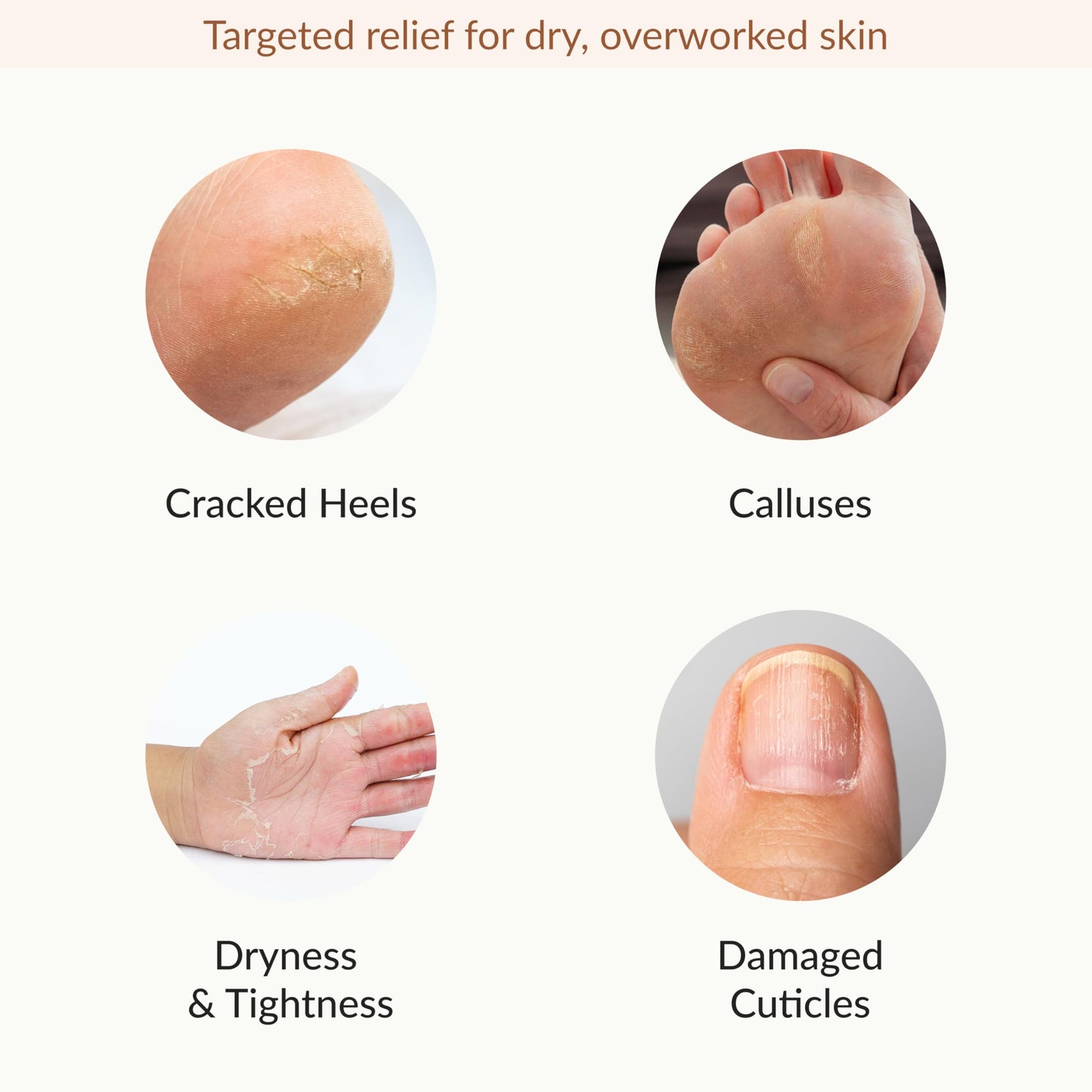 Epielle Hydrating & Moisturizing Hand & Foot Masks 12 Pairs, Relieve and Soften Dry Hands & Cracked Heels with Shea Butter & Sunflower Seed Oil, Korean Skin Care, Spa Set, Self Care Gifts for Women