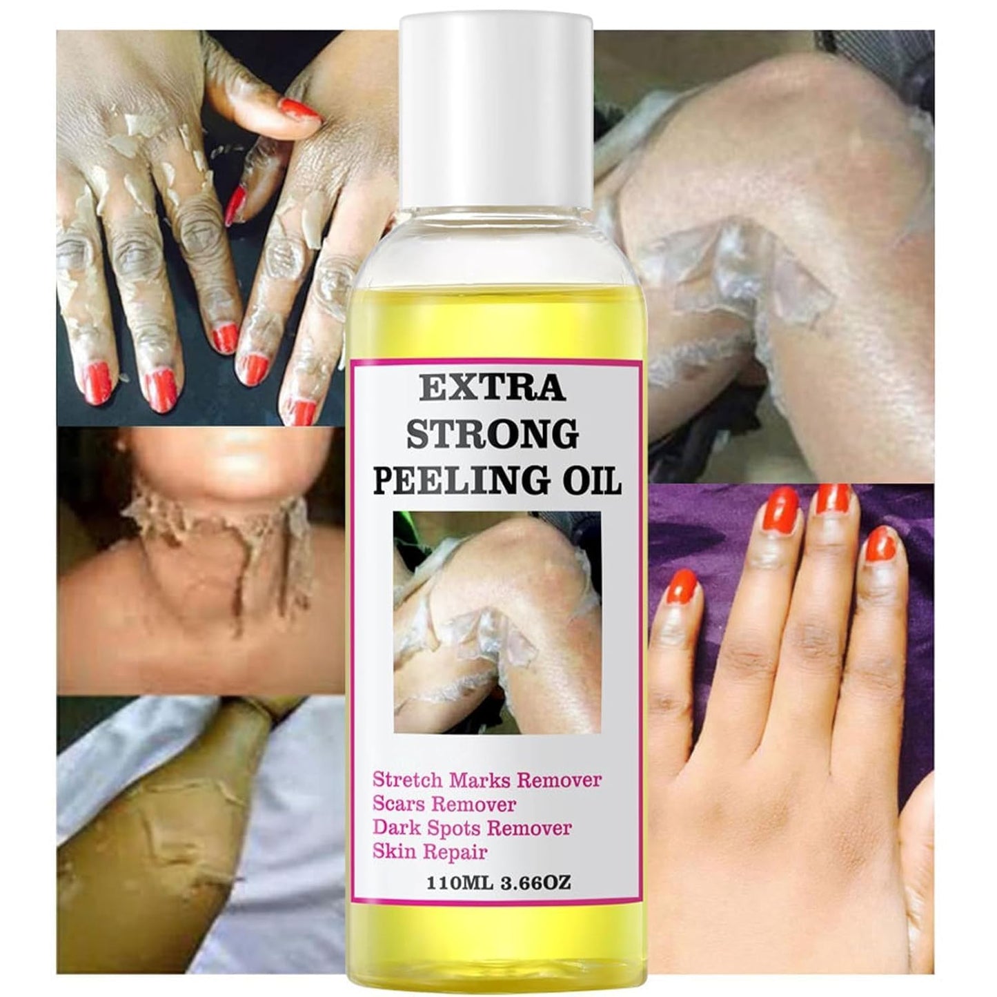 Extra Strong Peeling Oil, Yellow Peeling Oil for Dark Skin, Exfoliating Peeling Solution for Body, Hand, Feet and Face All Skin Type (110ML/3.88 Fl Oz) (1pcs)