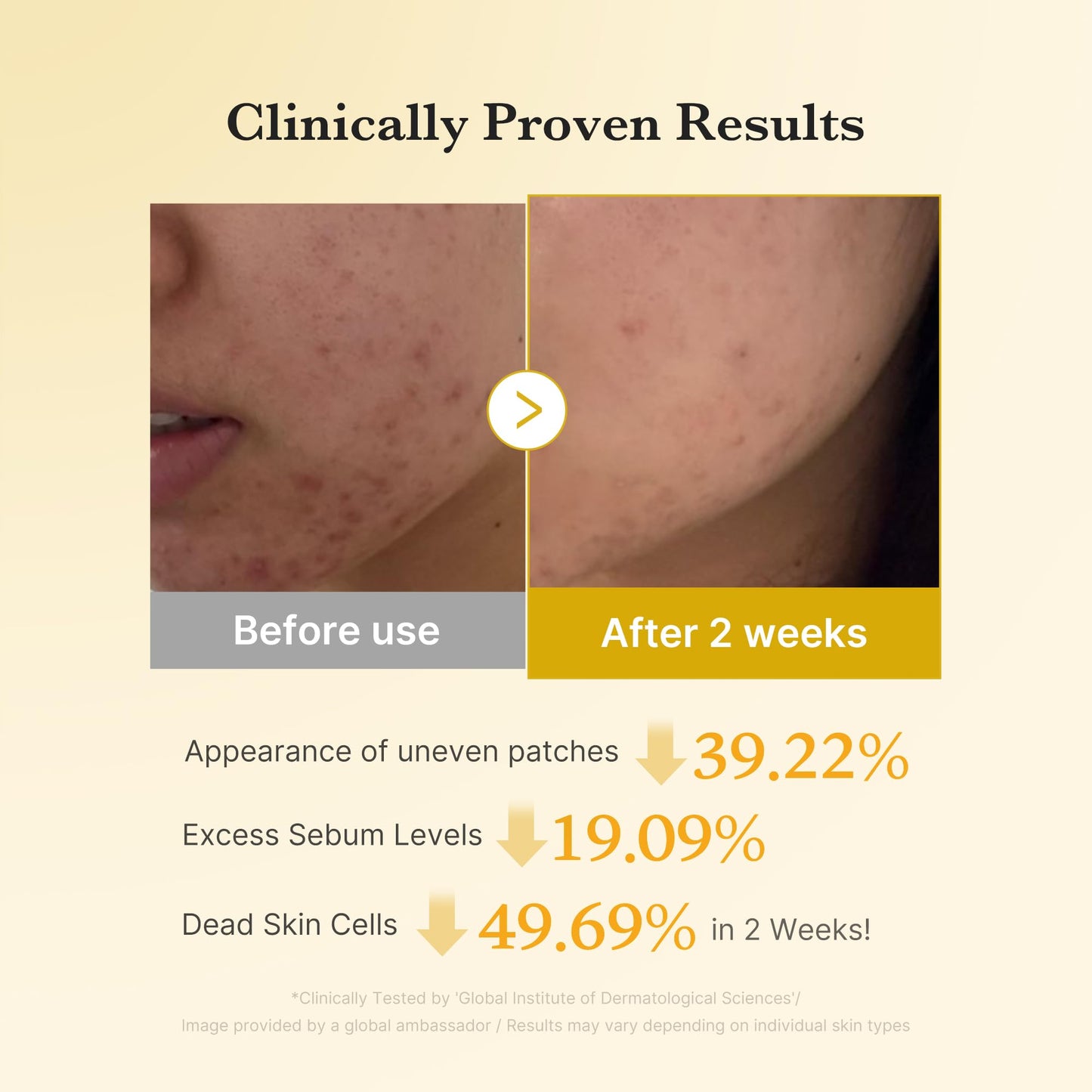 medicube Kojic Acid Turmeric Clarifying Toner Pad for Troubled Skin & Use After Spot Care, Soothing & Calming with Kojic Acid, Turmeric, Niacinamide & Glycolic Acid, Korean Skin Care, 70 Pads, 1 Pack