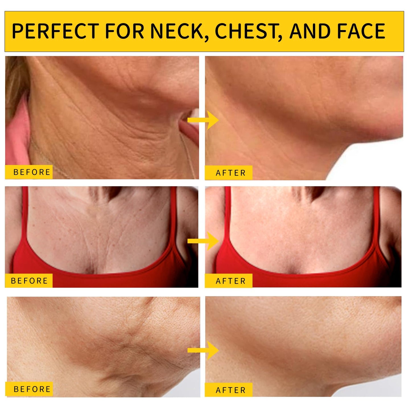 Irismistx Neck Cream, Neck Tightening Cream, Skin Firming & Anti Wrinkle Face Cream, Skin Tightening Cream for Face, Neck, Chest & Décolleté.