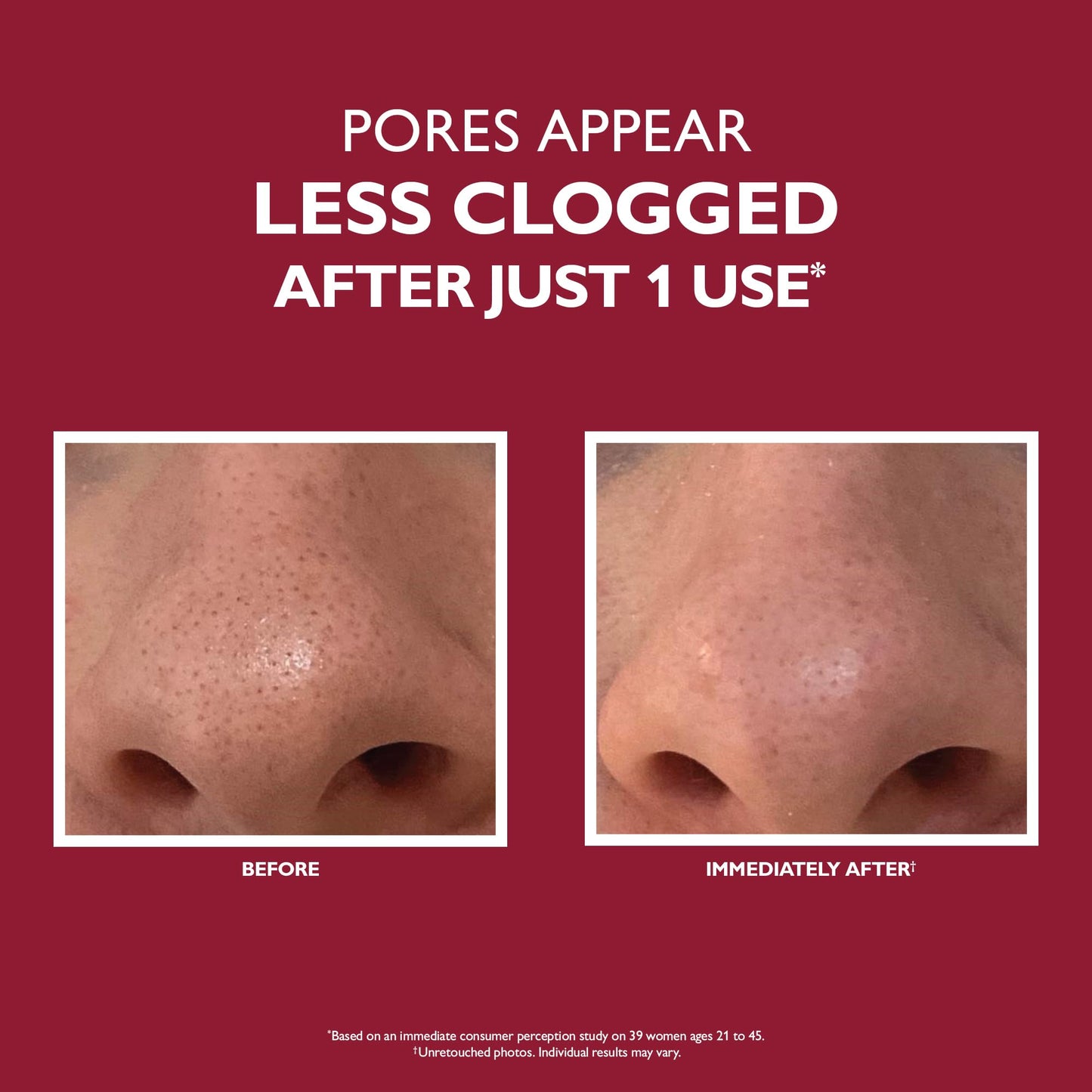 Peter Thomas Roth | Even Smoother™ Microdermabrasion Exfoliating Pore Purifier