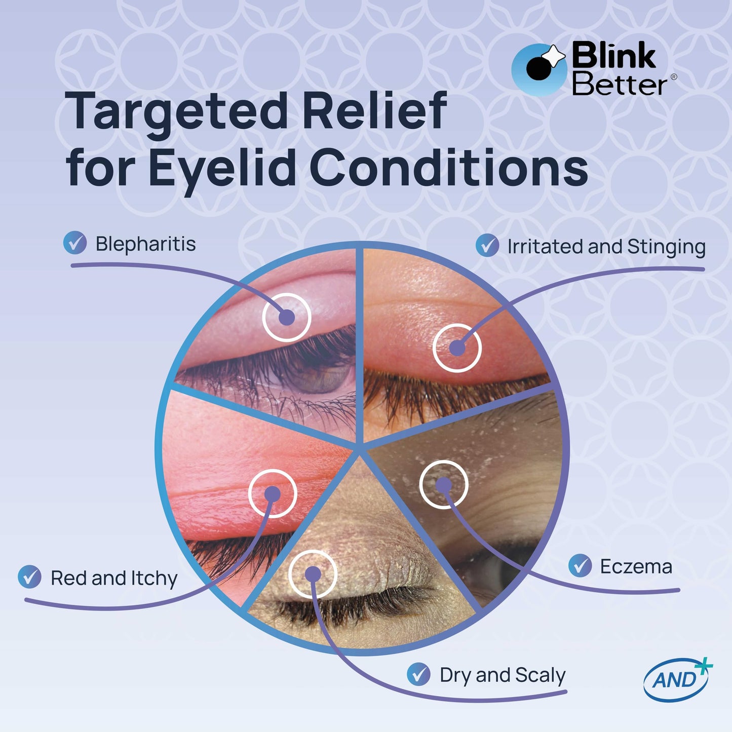 BetterLids Eyelid Ointment – Intense Oat Complex with Shea Butter & Panthenol - Hydrates, Nourishes & Soothes – Moisturizing Care for Dry, Itchy, Red, Sensitive, Flaky Skin Around the Eyes - 0.35 oz