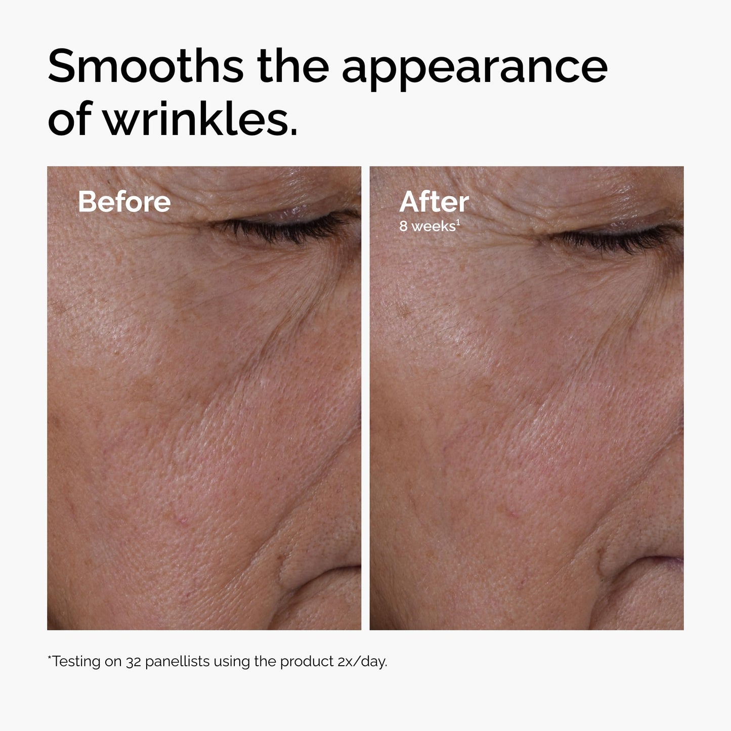 The Ordinary Multi-Peptide + Hyaluronic Acid, Anti-Aging Formula for Crow’s Feet, Elasticity & Firmness, 1 Fl Oz