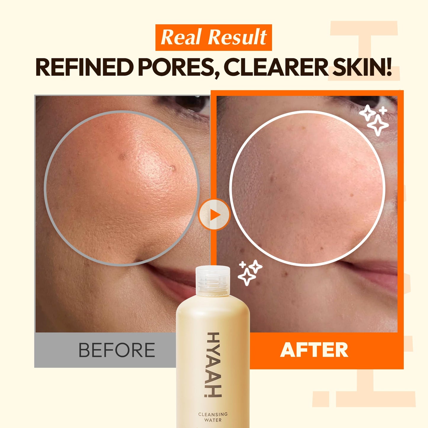 HYAAH Mild But Deep Cleansing Water - Micellar Water Makeup Remover Oil Free Facial Cleanser for Sensitive Skin - Gently Exfoliates, Hydrates - Korean Skincare, 10.14 fl.oz.