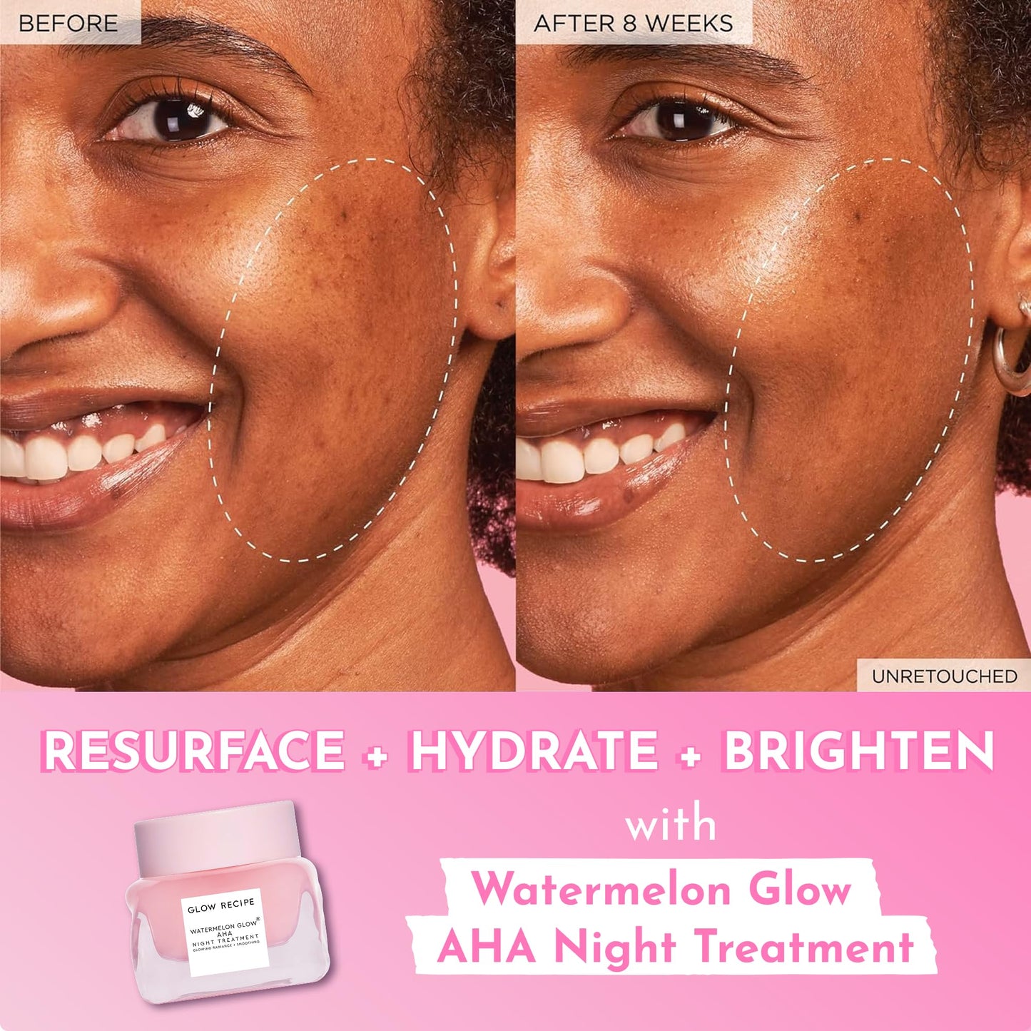 Glow Recipe Watermelon Glow AHA Night Treatment - Overnight Resurfacing Mask with AHA Complex, Hyaluronic Acid, Niacinamide & Watermelon Enzymes for Smooth, Glowing, Even-Toned Skin (60ml)